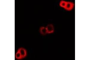Immunofluorescent analysis of DNAJA3 staining in U2OS cells. (DNAJA3 抗体)