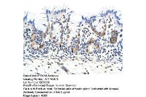 Rabbit Anti-PRKRA Antibody  Paraffin Embedded Tissue: Human Stomach Cellular Data: Epithelial cells of fundic gland Antibody Concentration: 4. (PRKRA 抗体  (Middle Region))