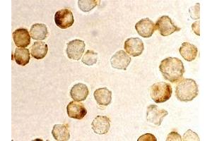 Immunohistochemistry (IHC) image for anti-Metastasis Associated 1 Family, Member 2 (MTA2) antibody (ABIN1031775) (MTA2 抗体)