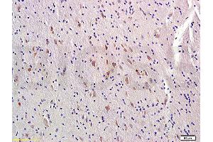 Formalin-fixed and paraffin-embedded rat brain labeled with Rabbit Anti-MTNR1A/MTR-1A/MEL-1A-R Polyclonal Antibody, Unconjugated (ABIN723815) at 1:300 followed by conjugation to the secondary antibody (Melatonin Receptor 1A 抗体  (AA 201-280))