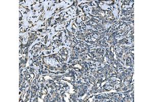IHC analysis of SPG3A/ATL1 using anti-SPG3A/ATL1 antibody (ABIN7603095). (ATL1 抗体  (Middle Region))