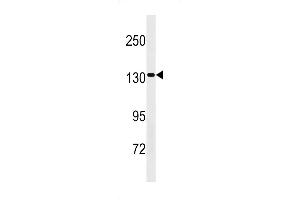 SS2 Antibody (Center) 20308c western blot analysis in HepG2 cell line lysates (35 μg/lane). (SAPS2 抗体  (AA 565-593))