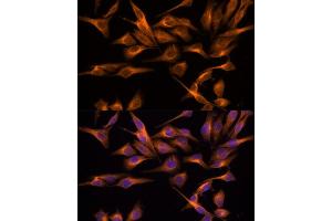 Immunofluorescence analysis of HeLa cells using UNG antibody (ABIN6135163, ABIN6149935, ABIN6149937 and ABIN6217044) at dilution of 1:100. (UNG 抗体  (AA 1-100))