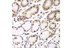 Immunohistochemistry (Paraffin-embedded Sections) (IHC (p)) image for anti-Ring Finger Protein 2 (RNF2) (AA 1-336) antibody (ABIN6147029)