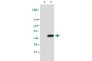 Western blot analysis of Lane 1: HEK293T cell lysate, Lane 2: IL3RA (a. (IL3RA 抗体)