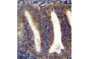 Immunohistochemistry (Paraffin-embedded Sections) (IHC (p)) image for anti-RNA Binding Protein with Multiple Splicing 2 (RBPMS2) (AA 120-149), (Middle Region) antibody (ABIN954489)