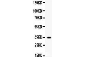 Anti- HGF antibody, Western blotting All lanes: Anti HGF  at 0.