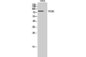 Western Blotting (WB) image for anti-Tripartite Motif Containing 3 (TRIM3) (N-Term) antibody (ABIN3187338) (TRIM3 抗体  (N-Term))