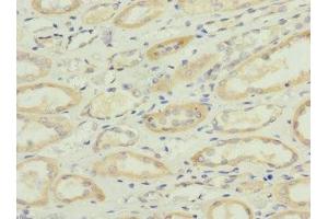 Immunohistochemistry of paraffin-embedded human kidney tissue using ABIN7170943 at dilution of 1:100 (Sulfide:quinone Oxidoreductase, Mitochondrial (SQOR) (AA 211-450) 抗体)