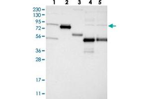 Western blot analysis of Lane 1: RT-4, Lane 2: U-251 MG, Lane 3: Human Plasma, Lane 4: Liver, Lane 5: Tonsil with GLT25D2 polyclonal antibody  at 1:250-1:500 dilution. (GLT25D2 抗体)
