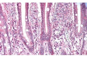 Immunohistochemistry (IHC) image for anti-Amiloride Binding Protein 1 (Amine Oxidase (Copper-Containing)) (ABP1) (AA 347-466) antibody (ABIN7432325)