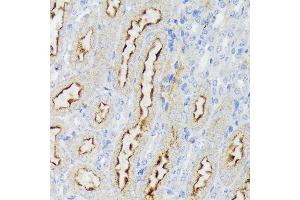 Immunohistochemistry of paraffin-embedded mouse kidney using Nectin 2/CD112 Rabbit mAb (ABIN7269432) at dilution of 1:100 (40x lens). (PVRL2 抗体)