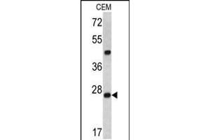 Western blot analysis of Dcr-1 antibody in CEM cell line lysates (35ug/lane) (Endoribonuclease Dcr-1 (Dcr-1) (AA 1068-1097) 抗体)