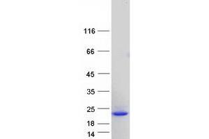 Validation with Western Blot (FGF1 Protein (Transcript Variant 4) (Myc-DYKDDDDK Tag))