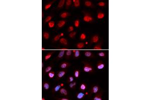 Immunofluorescence (IF) image for anti-Ring Finger Protein 2 (RNF2) antibody (ABIN1876743)