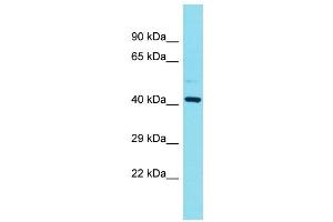 Western Blotting (WB) image for anti-Family with Sequence Similarity 181, Member B (FAM181B) (N-Term) antibody (ABIN2791533) (FAM181B 抗体  (N-Term))