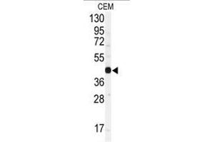 Image no. 1 for anti-Gap Junction Protein, alpha 1, 43kDa (GJA1) (N-Term) antibody (ABIN357085) (Connexin 43/GJA1 抗体  (N-Term))
