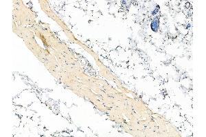 Phospho-CXCR4 (Ser339) Antibody at 1/100 staining Rat skin tissue by IHC-P. (CXCR4 抗体  (pSer339))