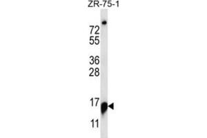 Western Blotting (WB) image for anti-Ribonuclease P/MRP 25kDa Subunit (RPP25) antibody (ABIN2997146) (RPP25 抗体)