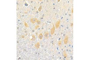 Immunohistochemistry (Paraffin-embedded Sections) (IHC (p)) image for anti-ELKS/RAB6-Interacting/CAST Family Member 2 (ERC2) antibody (ABIN7073808)