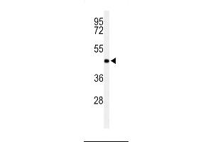 Western blot analysis of RPR1B Antibody in Jurkat cell line lysates (35ug/lane) (RPRD1B 抗体  (C-Term))