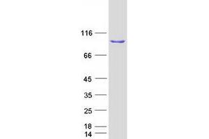 Western Blotting (WB) image for Iron-Responsive Element Binding Protein 2 (IREB2) protein (Myc-DYKDDDDK Tag) (ABIN2723785)