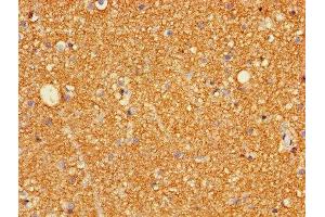 Immunohistochemistry of paraffin-embedded human brain tissue using ABIN7153961 at dilution of 1:100 (Glutamate Receptor 3 抗体  (AA 151-250))