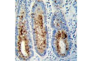 Anti-Myeloperoxidase antibody immunohistochemistry analysis in formalin fixed and paraffin embedded human colon tissue. (Myeloperoxidase 抗体  (AA 420-448))
