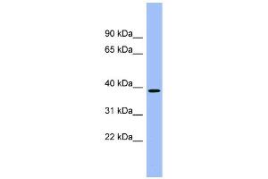 WB Suggested Anti-ACMSD Antibody Titration:  0. (ACMSD 抗体  (Middle Region))