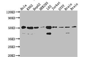 Western Blot Positive WB detected in: Hela whole cell lysate, K562 whole cell lysate, HepG2 whole cell lysate, HEK293 whole cell lysate, L02 whole cell lysate, Jurkat whole cell lysate, SH-SY5Y whole cell lysate, Mouse Brain whole cell lysate, Rat Brain cell lysate All lanes: RbAp48 antibody at 1:1000 Secondary Goat polyclonal to rabbit IgG at 1/50000 dilution Predicted band size: 48, 48, 47, 44 kDa Observed band size: 53, 40 kDa (Recombinant Retinoblastoma Binding Protein 4 抗体)