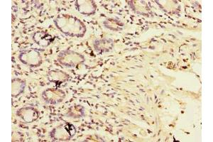 Immunohistochemistry of paraffin-embedded human small intestine tissue using ABIN7159912 at dilution of 1:100 (TIMM9 抗体  (AA 2-89))