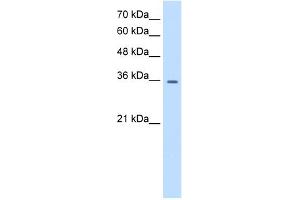 WB Suggested Anti-TRPM5 Antibody Titration:  0. (TRPM5 抗体  (N-Term))