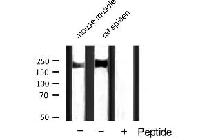 Western Blotting (WB) image for anti-Receptor tyrosine-protein kinase erbB-2 (ErbB2/Her2) (pTyr1248) antibody (ABIN6256630)