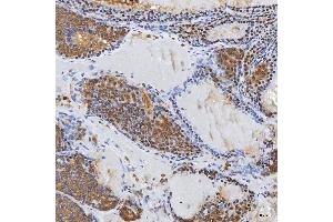 IHC analysis of Syntenin 2/SDCBP2 using anti-Syntenin 2/SDCBP2 antibody (ABIN7600017).