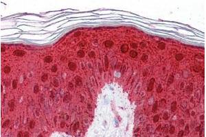 Human Skin: Formalin-Fixed, Paraffin-Embedded (FFPE) (14-3-3 sigma/SFN 抗体  (AA 179-228))