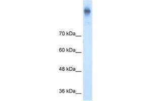 Western Blotting (WB) image for anti-Solute Carrier Family 12 (Potassium-Chloride Transporter) Member 2 (SLC12A2) antibody (ABIN2462733)