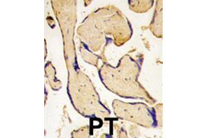 Formalin-fixed and paraffin-embedded human placenta tissue reacted with EPHA3 polyclonal antibody , which was peroxidase-conjugated to the secondary antibody, followed by DAB staining. (EPH Receptor A3 抗体  (C-Term))