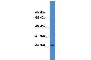 WB Suggested Anti-OTUB2 Antibody Titration: 0. (OTUB2 抗体  (N-Term))