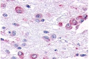 Human Brain, Hypothalamus (formalin-fixed, paraffin-embedded) stained with GPR101 antibody ABIN291950 at 7. (GPR101 抗体  (Cytoplasmic Domain))