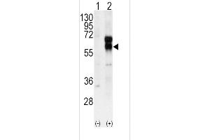 Western blot analysis of ACVRL1 using rabbit polyclonal ACVRL1 Antibody using 293 cell lysates (2 ug/lane) either nontransfected (Lane 1) or transiently transfected with the ACVRL1 gene (Lane 2). (ACVRL1 抗体  (N-Term))