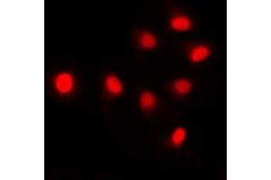 Immunofluorescent analysis of SIN3B staining in HCT116 cells. (SIN3B 抗体  (Center))