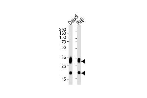 Western blot analysis of lysates from Daudi, Raji cell line (from left to right), using CD74 Antibody (ABIN1944838 and ABIN2838498). (CD74 抗体  (AA 1-232))