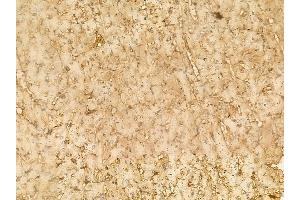 Alanine Transaminase Mouse Monoclonal Antibody at 1/100 staining rat heart tissue by IHC-P. (ALT 抗体)