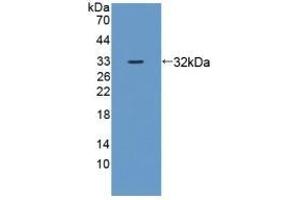Detection of Recombinant ZRF1, Mouse using Polyclonal Antibody to Zuotin Related Factor 1 (ZRF1) (DNAJC2 抗体  (AA 368-621))