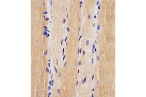 (ABIN6242880 and ABIN6578225) staining USP47 in human skeletal muscle tissue sections by Immunohistochemistry (IHC-P - paraformaldehyde-fixed, paraffin-embedded sections). (USP47 抗体  (AA 588-620))