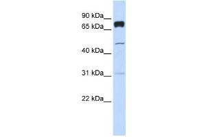 Western Blotting (WB) image for anti-Pleckstrin Homology Domain Containing, Family A (phosphoinositide Binding Specific) Member 4 (PLEKHA4) antibody (ABIN2458667) (PLEKHA4 抗体)