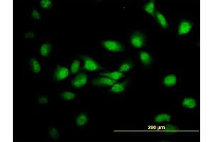 Immunofluorescence of monoclonal antibody to MDS028 on HeLa cell. (ITFG2 抗体  (AA 1-447))
