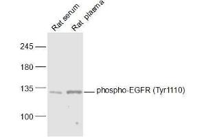 Lane 1: Rat serum lysates Lane 2: Rat plasma lysates probed with phospho-EGFR (Tyr1110) Polyclonal Antibody, Unconjugated  at 1:1000 dilution and 4˚C overnight incubation. (EGFR 抗体  (pTyr1110))
