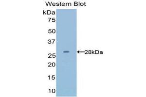 Western Blotting (WB) image for anti-Latexin (LXN) (AA 1-222) antibody (ABIN1078269) (Latexin 抗体  (AA 1-222))