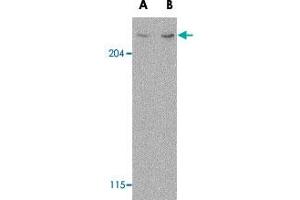 Western blot analysis of MTOR in L1210 cell lysate with MTOR polyclonal antibody  at (A) 1 and (B) 2 ug/mL . (MTOR 抗体  (N-Term))